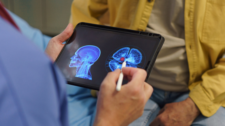 Doctor looks at tablet with image of brain scan, elder patient sitting across