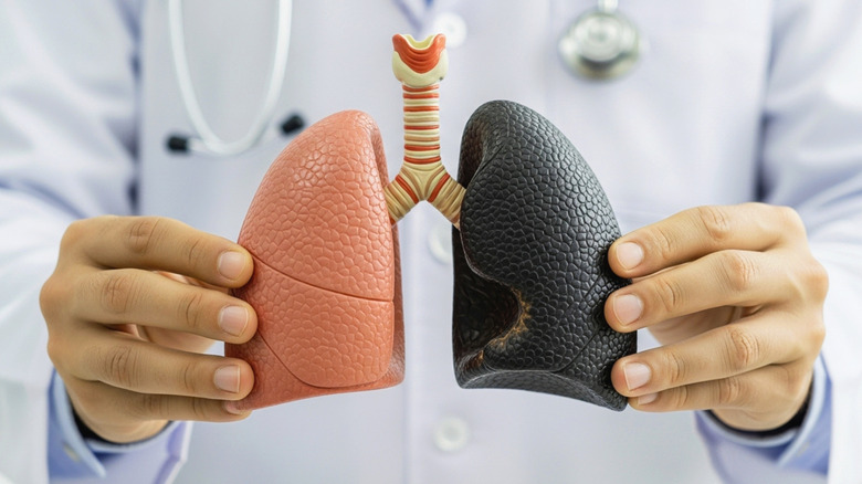 Doctor holding a model to demonstrate the difference between a healthy and unhealthy lung