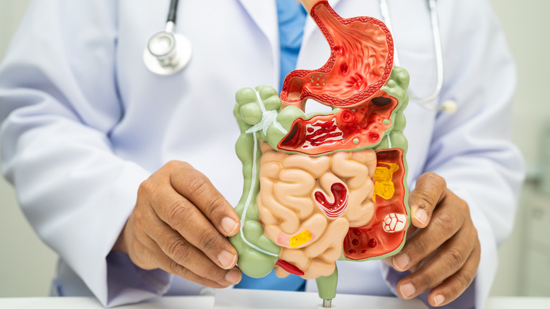 Medical professional in white coat holding a model of the human digestive system