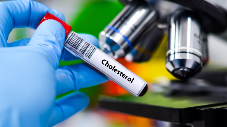 Gloved hand holding a cholesterol blood sample tube in lab