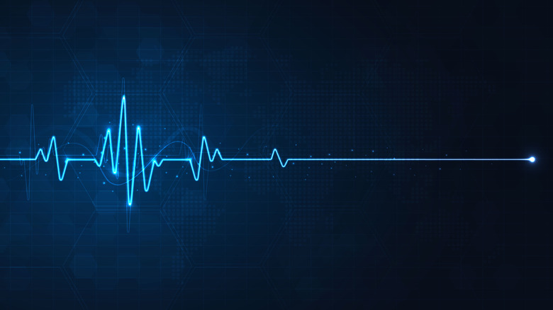 heart rate flatlining