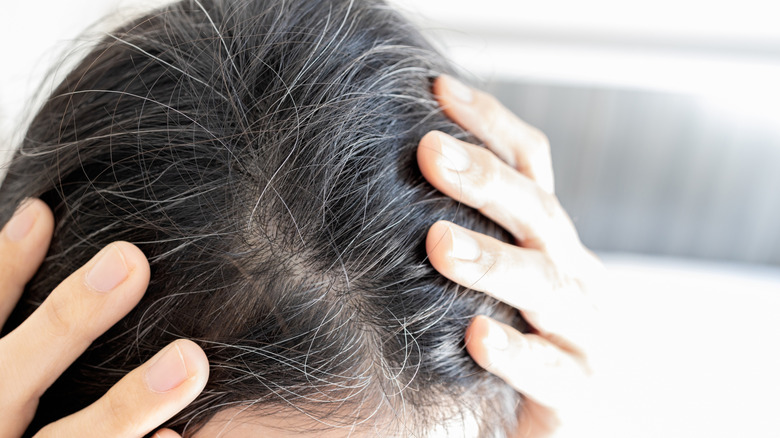 Dark-haired person with gray hair growing through
