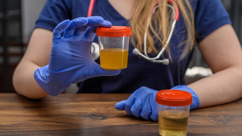 Doctor examining two containers or urine