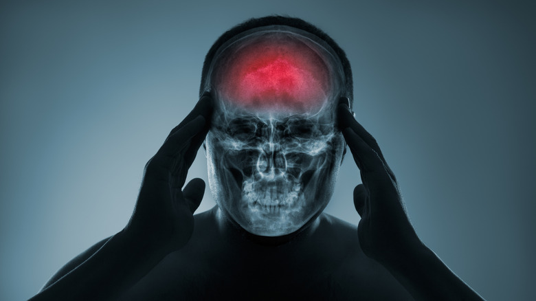 X-ray image of man's head with arms raised and brain highlighted in red