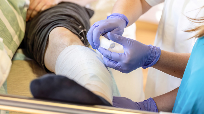 Medical staff applying bandage to leg of patient