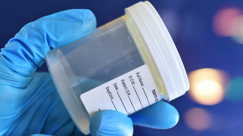 A gloved hand holding a plastic specimen cup