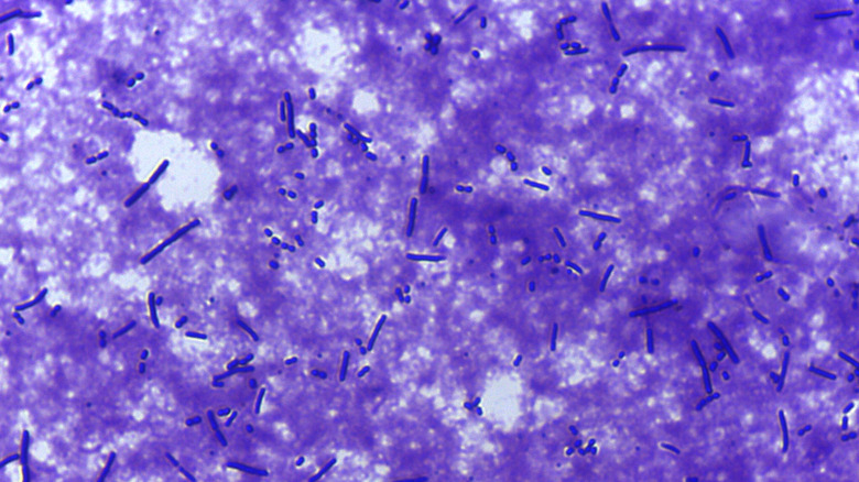 Microscope view of lactobacillus bacteria stained purple