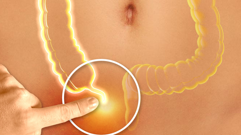 Finger pointing to out the location of the appendix on a hologram over an abdomen